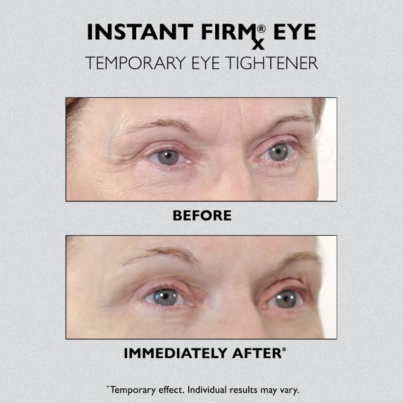 Instant FIRMx Eye Temporary Eye Tightener