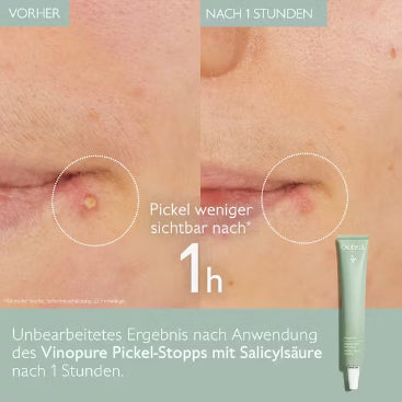 Vinopure - Pickel-Stopp mit Salicylsäure, 15ml