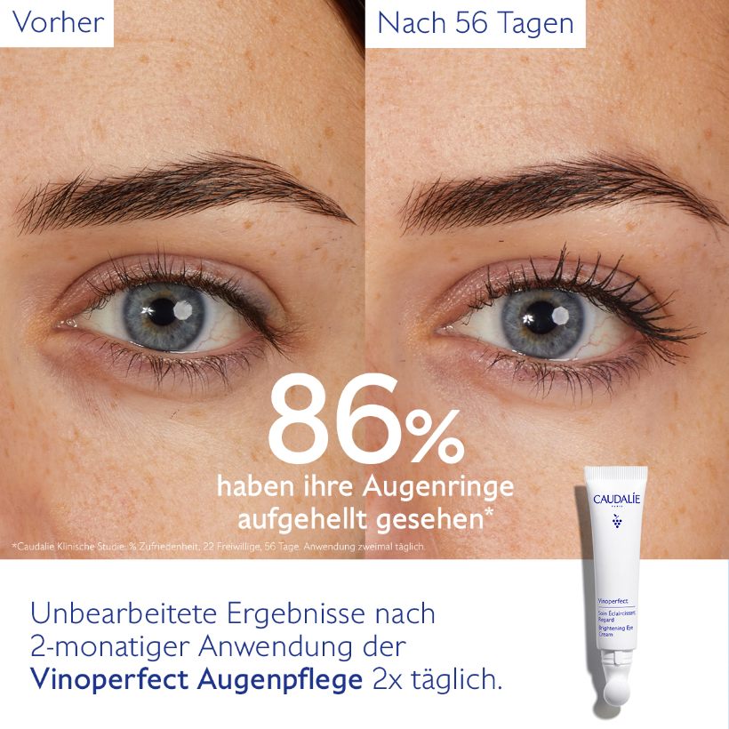 Vinoperfect - Aufhellende Augenpflege