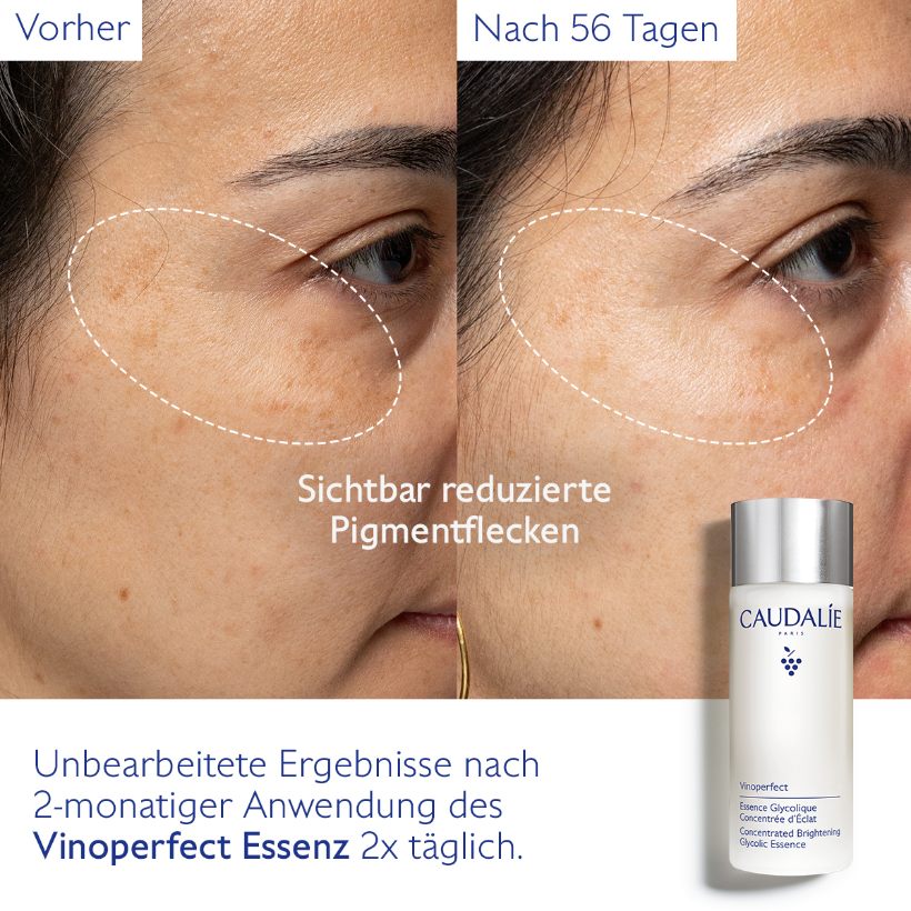 Vinoperfect - Essenz mit Glykolsäure für mehr Ausstrahlung