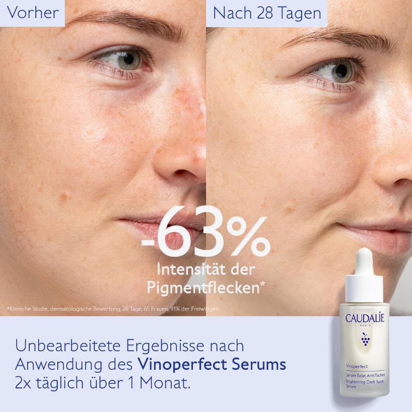 Vinoperfect - Serum für mehr Ausstrahlung und gegen Pigmentflecken, 30ml