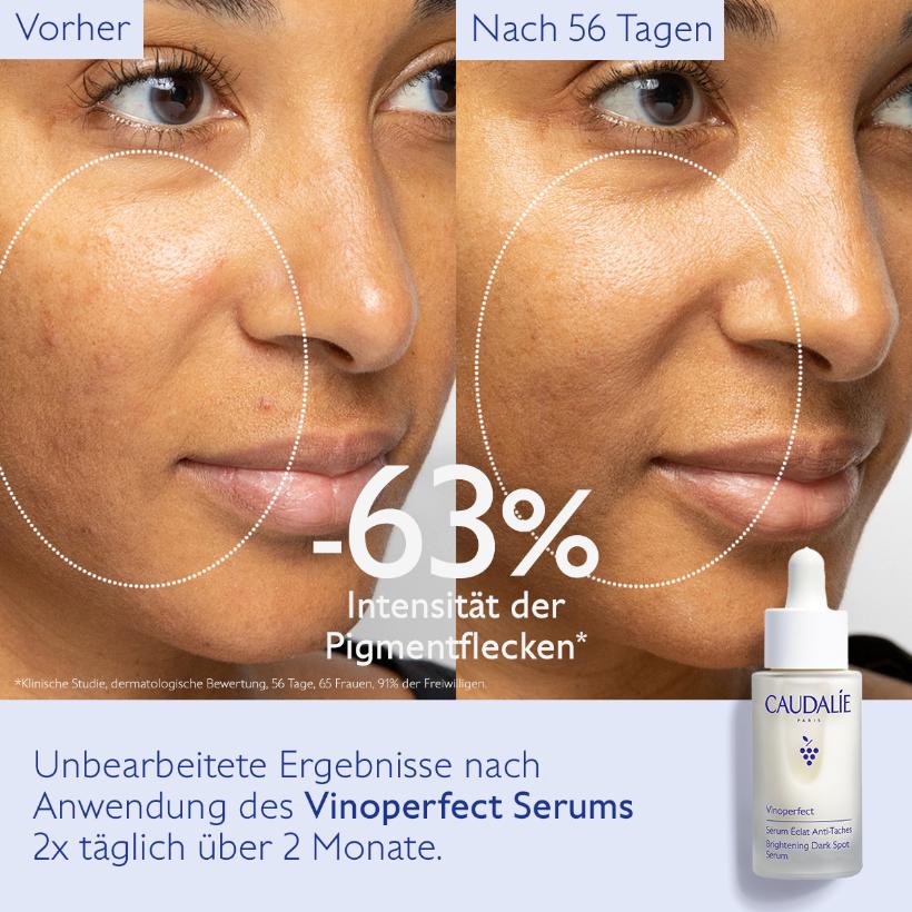 Vinoperfect - Serum für mehr Ausstrahlung und gegen Pigmentflecken, 30ml
