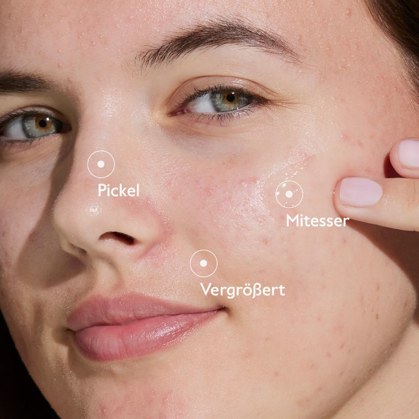 Vinopure - Serum with salicylic acid against impurities