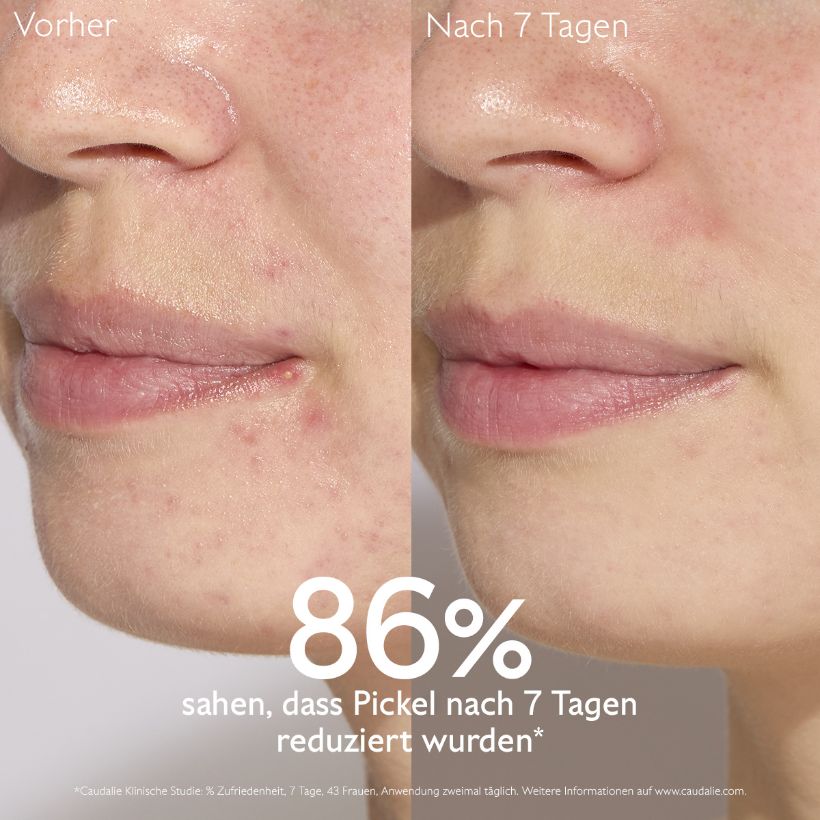 Vinopure - Serum with salicylic acid against impurities