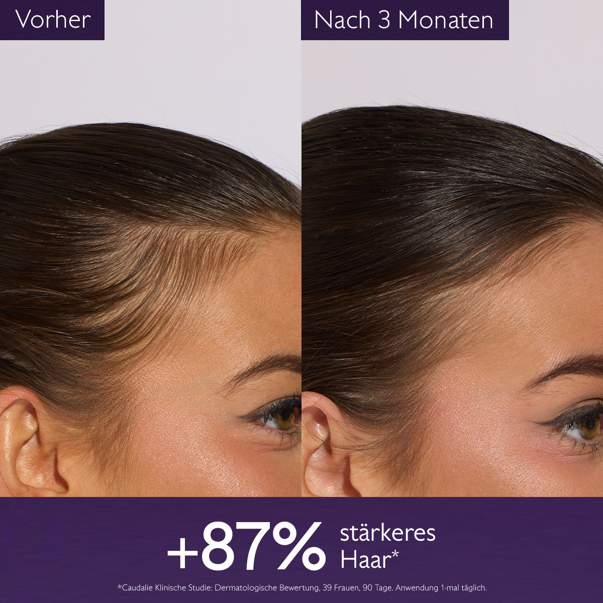 Haarpflege - Anti-Haarausfall-Haarserum