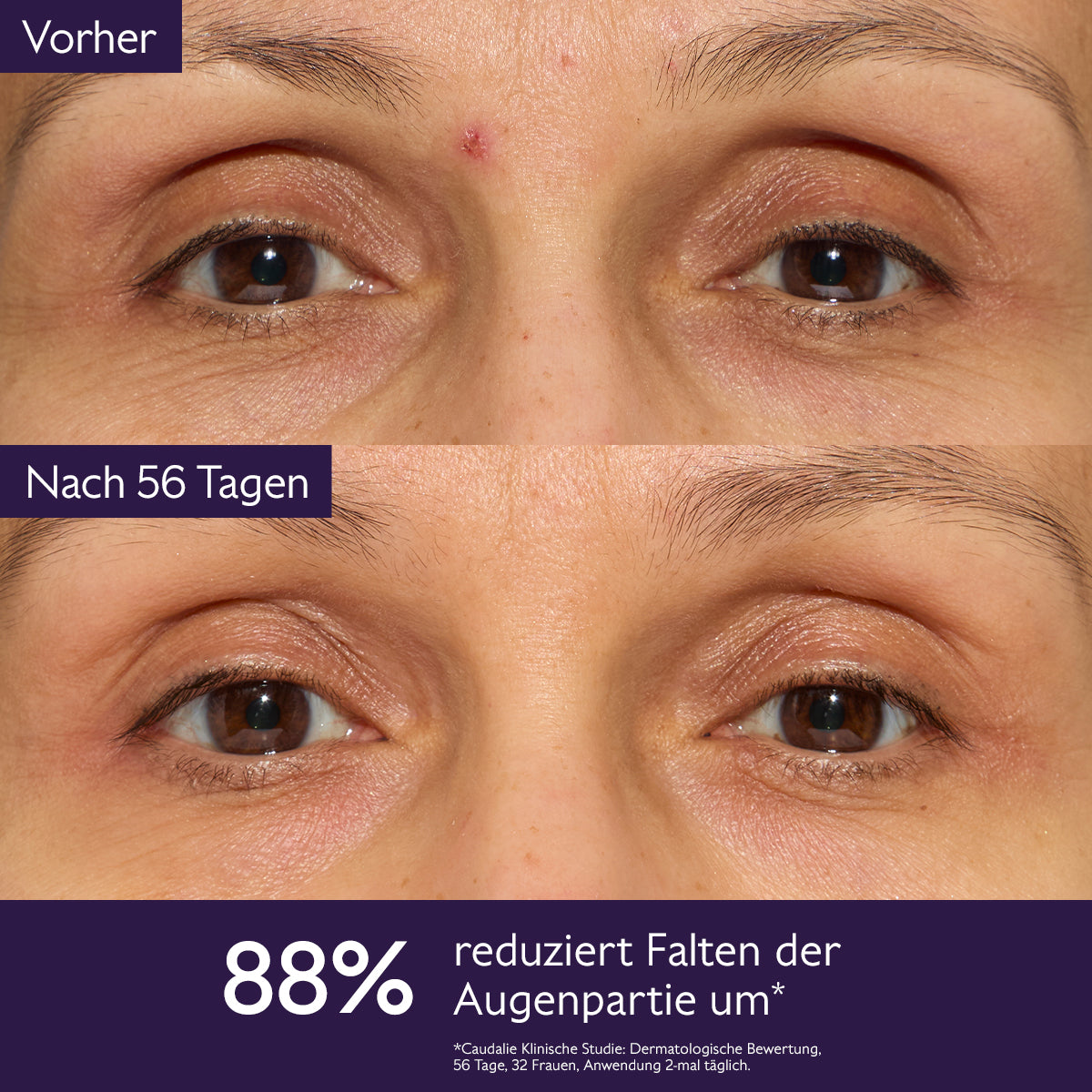 Premier Cru Die Globale Anti-Aging-Lösung