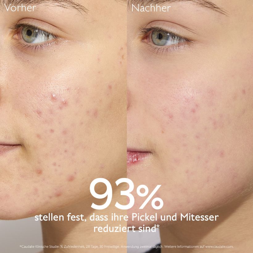 Vinopure - Mattifying moisturizing fluid with silicon powder