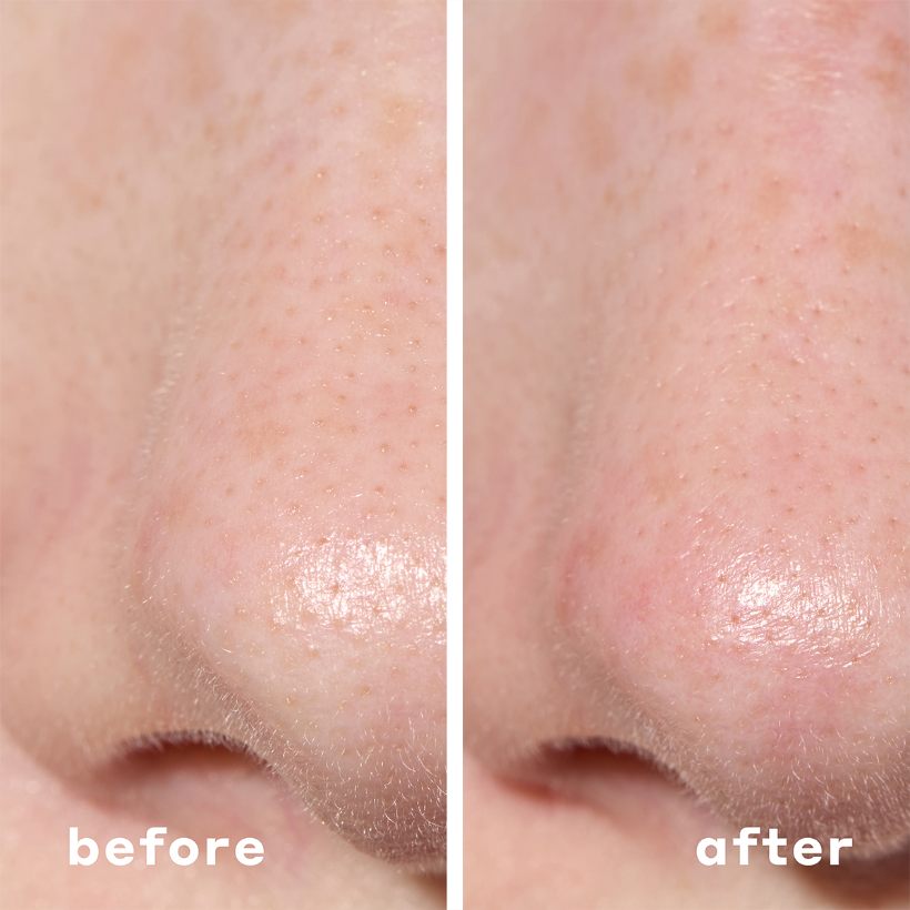 2-IN-1 Deep Cleansing Pore Strip