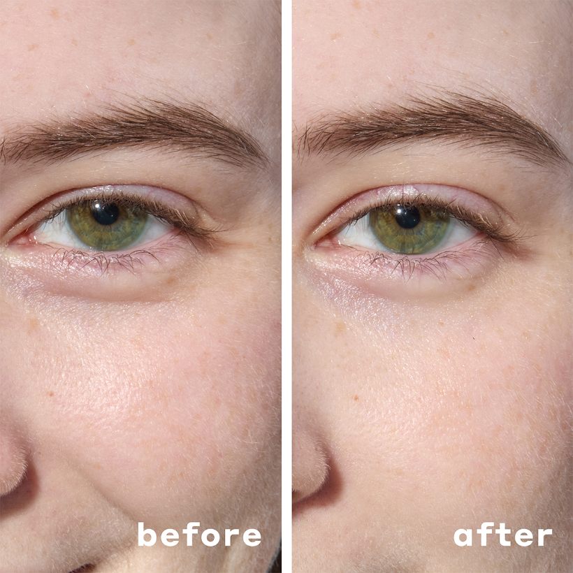 Cooling Hydrogel Under Eye Patches
