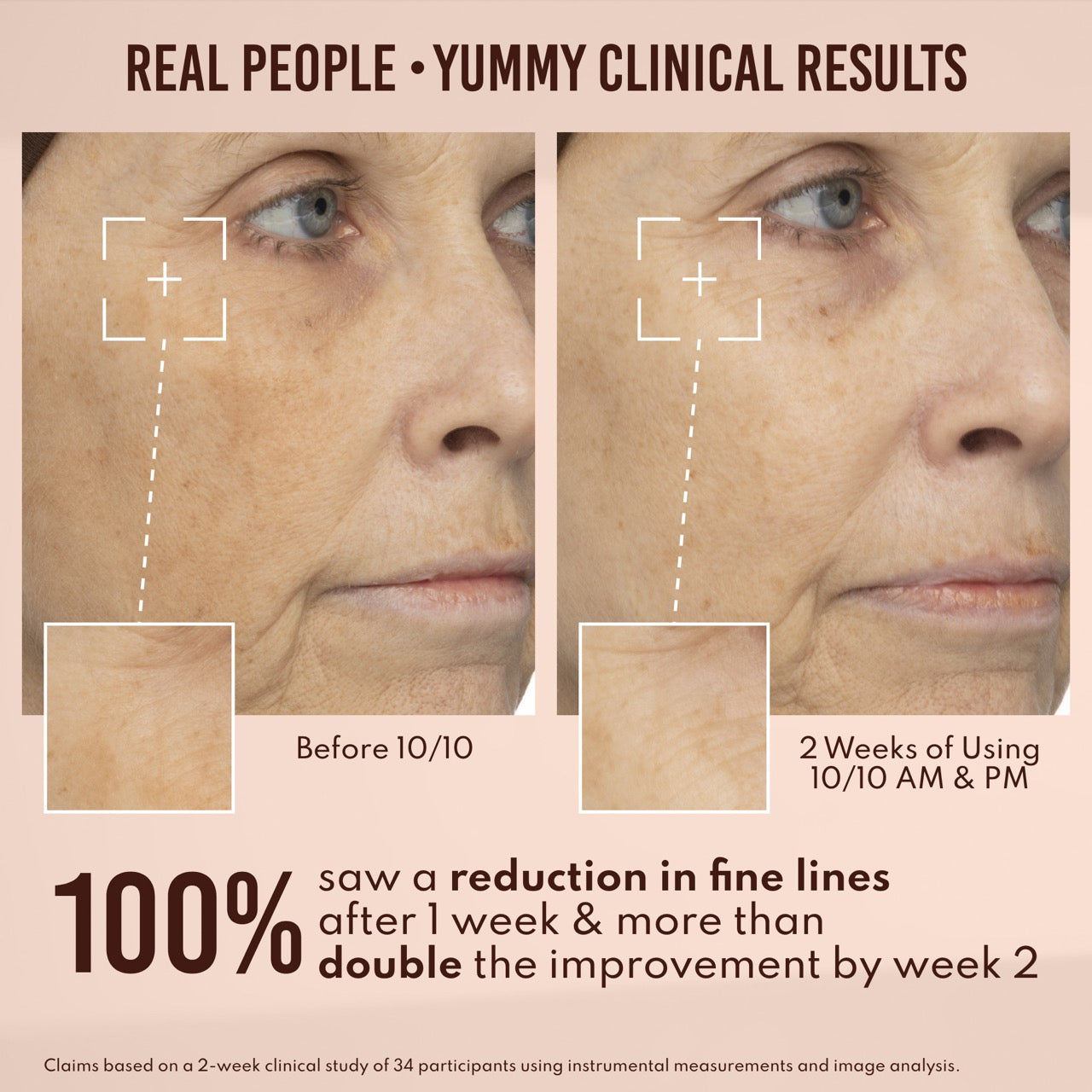 Yummy Skin 10/10 Barrier Boost