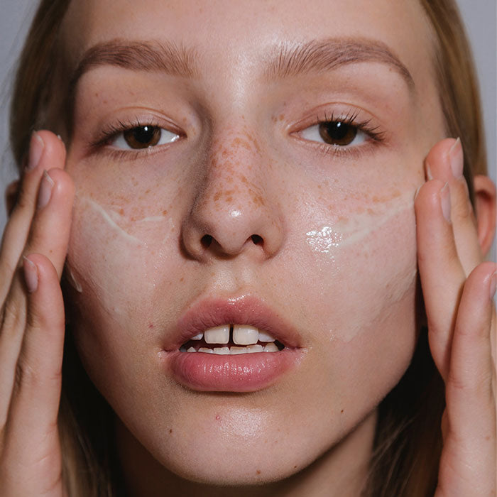 ACNE Hydra-Derm Ausgleichendes Fluid