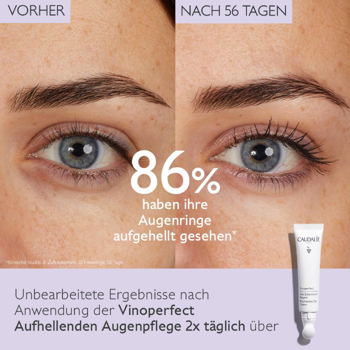 Vinoperfect - Aufhellende Augenpflege, 15ml