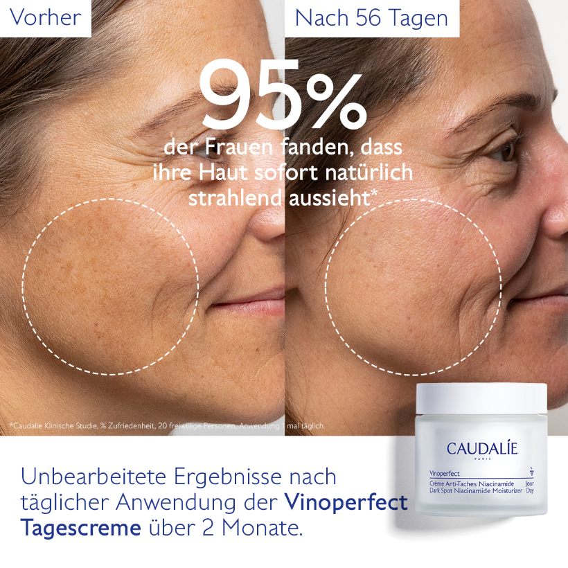 Vinoperfect - anti-pigmentation cream