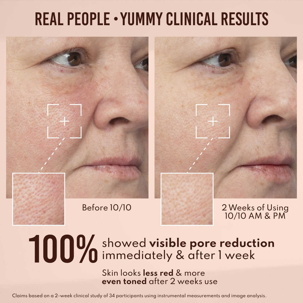 Yummy Skin 10/10 Barrier Boost