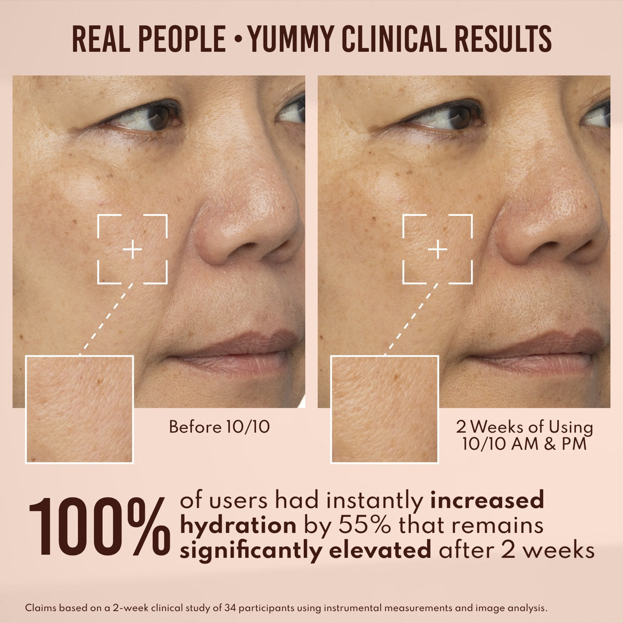 Yummy Skin 10/10 Barrier Boost