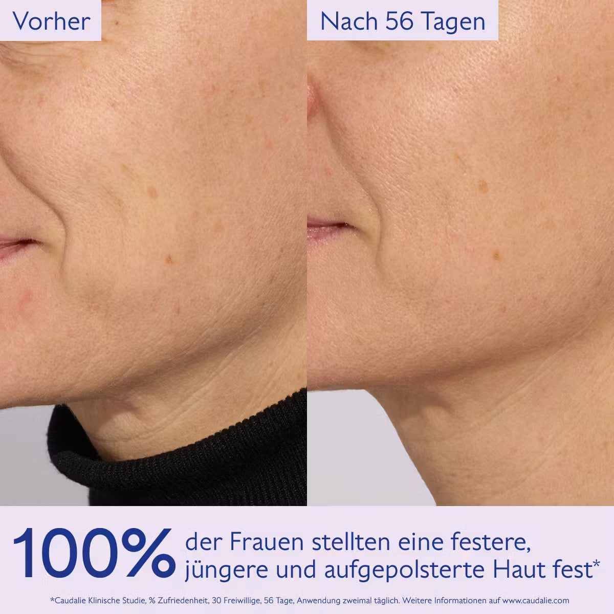 Resveratrol-Lift Lifting Straffungsserum