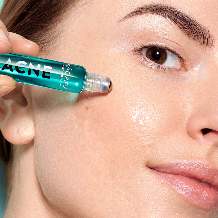 ACNE Akut Roll-on